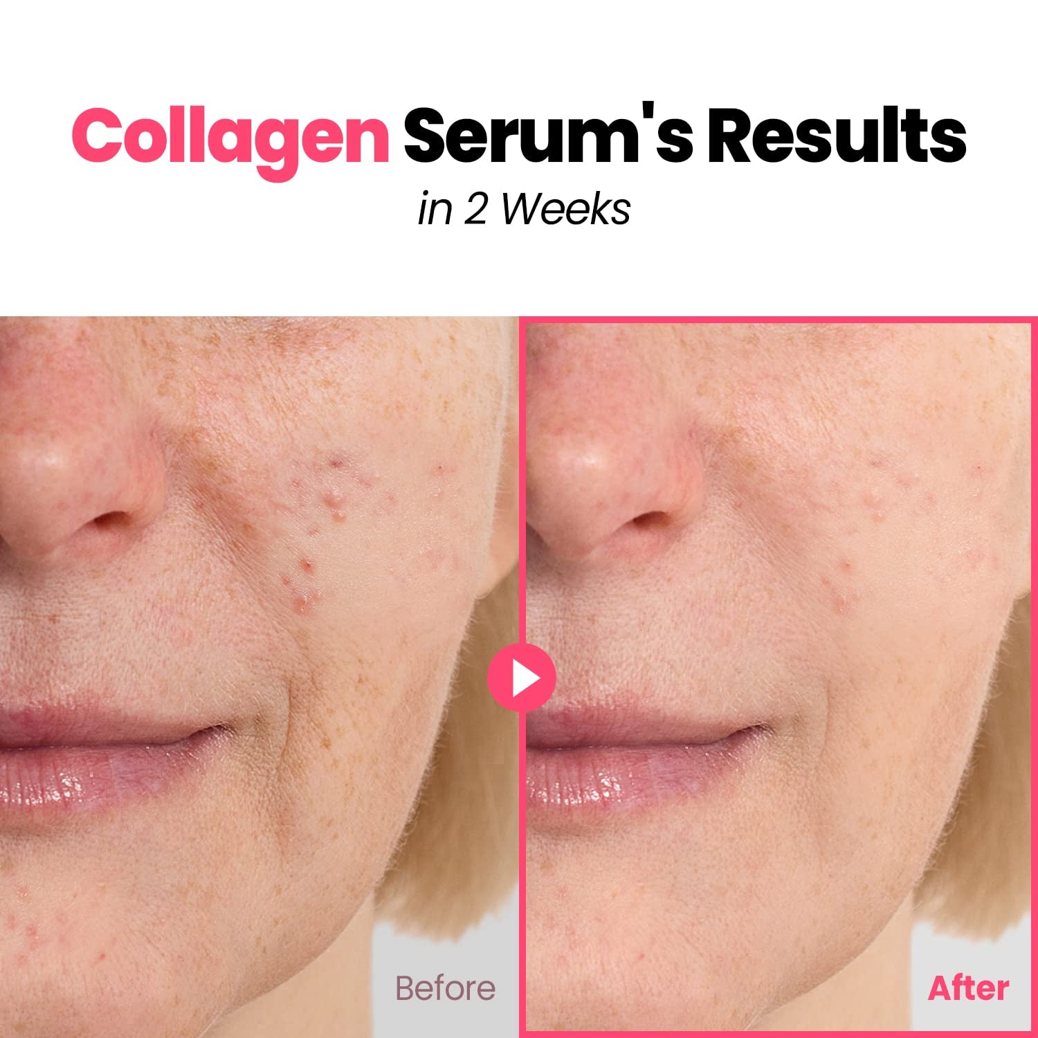 GLAM up Plump Nourishing Dive in Real Marine Collagen Serum - anti Aging with Hyaluronic Acid, Lifting,Tightening Skincare, Repair Skin with Peptide Complex Facial Serum 30Ml (1.01 Fl Oz)