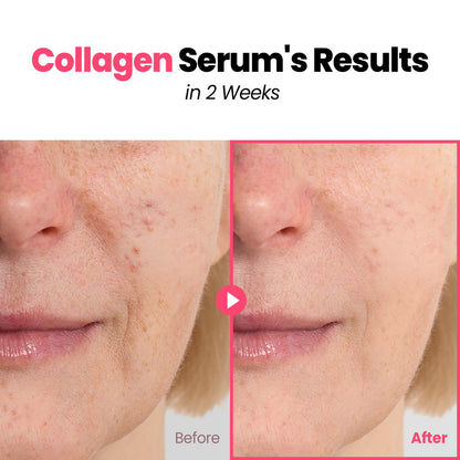 GLAM up Plump Nourishing Dive in Real Marine Collagen Serum - anti Aging with Hyaluronic Acid, Lifting,Tightening Skincare, Repair Skin with Peptide Complex Facial Serum 30Ml (1.01 Fl Oz)